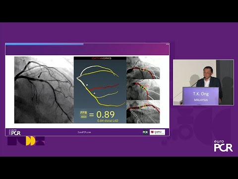 How do I confidently expand my DCB practice? - EuroPCR 2024