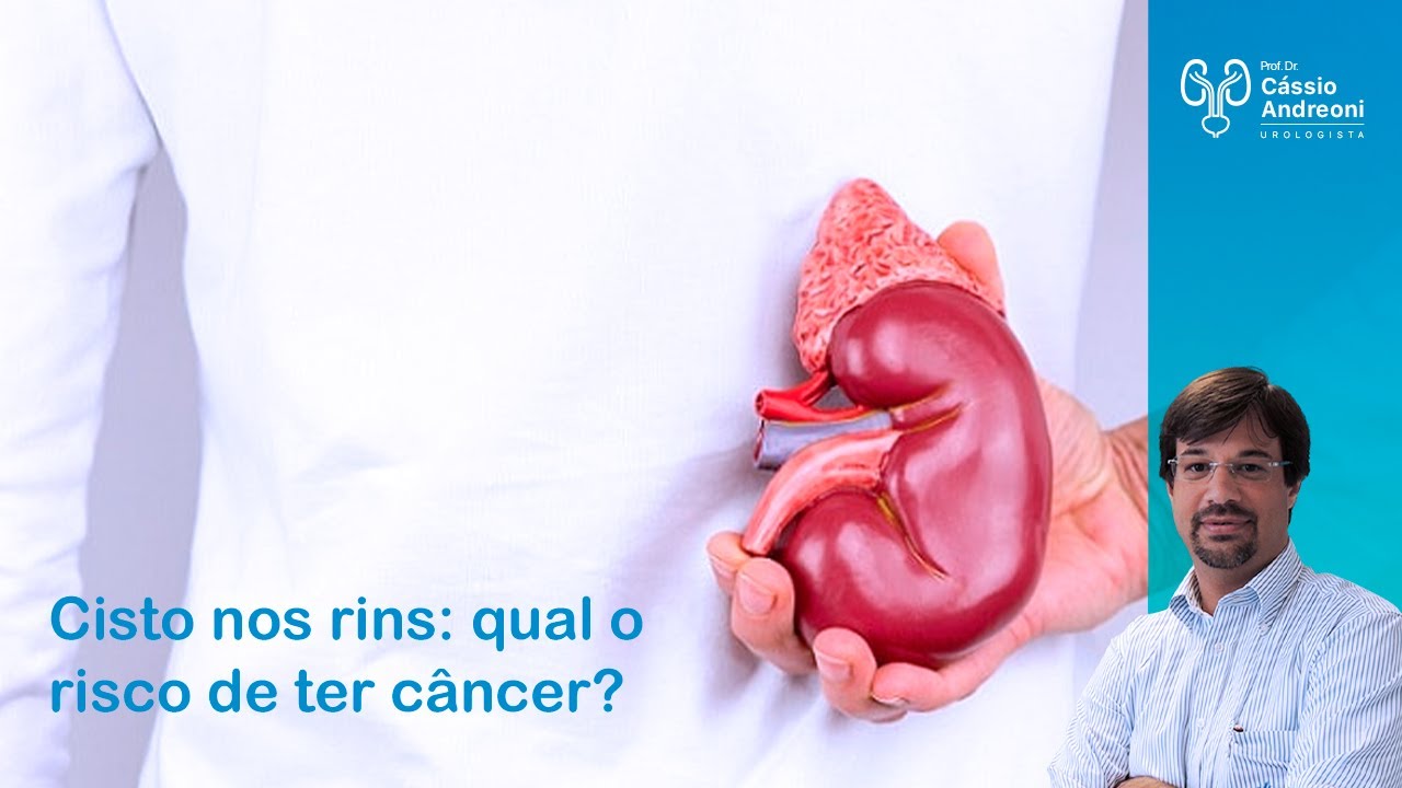 Cisto nos rins: qual o risco de ter câncer | Dr. Cassio Andreoni CRM 78.546