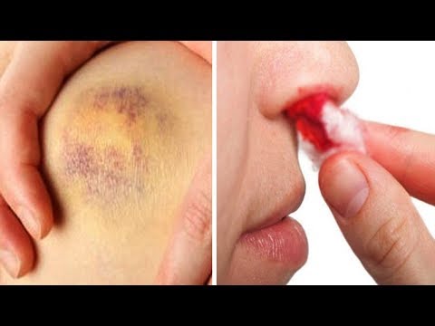 11 Shenja qe tregojne se Kanceri po rritet ne trupin tuaj, Vini re me kujdes