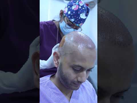 Kanhal Patel  -  India testimonial