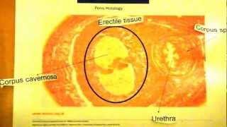Download lagu Inside Penis Outreach Movie mp3 Download lagu Inside Penis Outreach Movie mp3