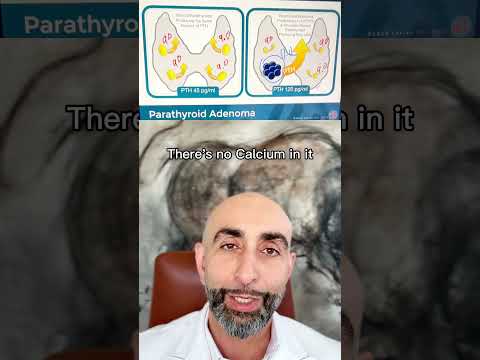 Should you avoid Calcium rich foods if you have hyperparathyroidism? Let’s talk about it.