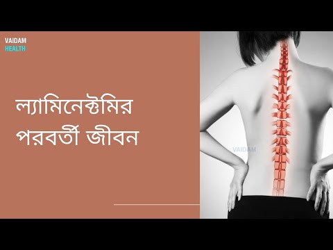 ল্যামিনেক্টমির পরবর্তী জীবন