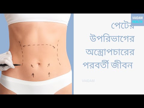 টামি টাকের পরবর্তী জীবন