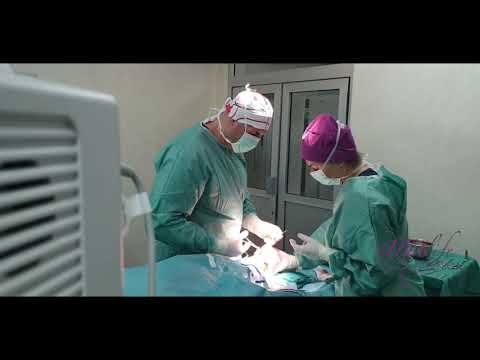 Kako rešiti rupturu Ahilove tetive? - Opšta Bolnica Analife