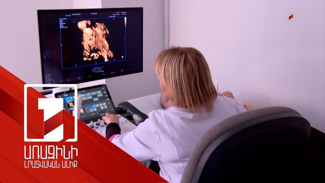 Պտղի արհեստական ընդհատումը կթույլատրվի իրականացնել դեղորայքներով