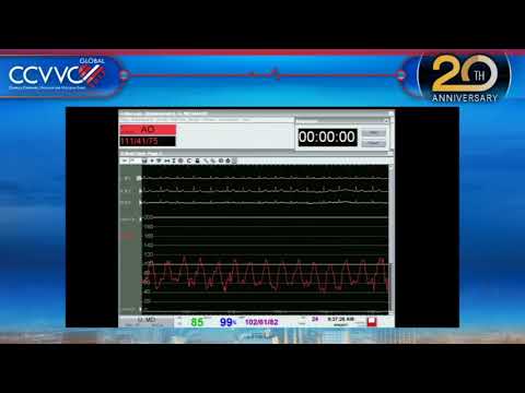 Live Case 2 - High-Risk PCI of LM Bifurcation - CCVVC 2017