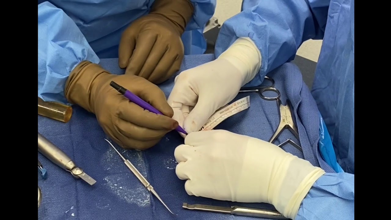 Dr. Garcia demonstrates a cartilage transplant surgery.