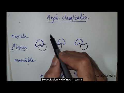 Angle classification of Malocclusion (Easy)