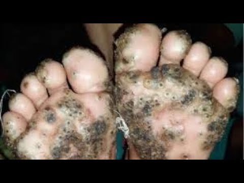 BICHO DE PÉ! 120segundos 45| BláBláLogia