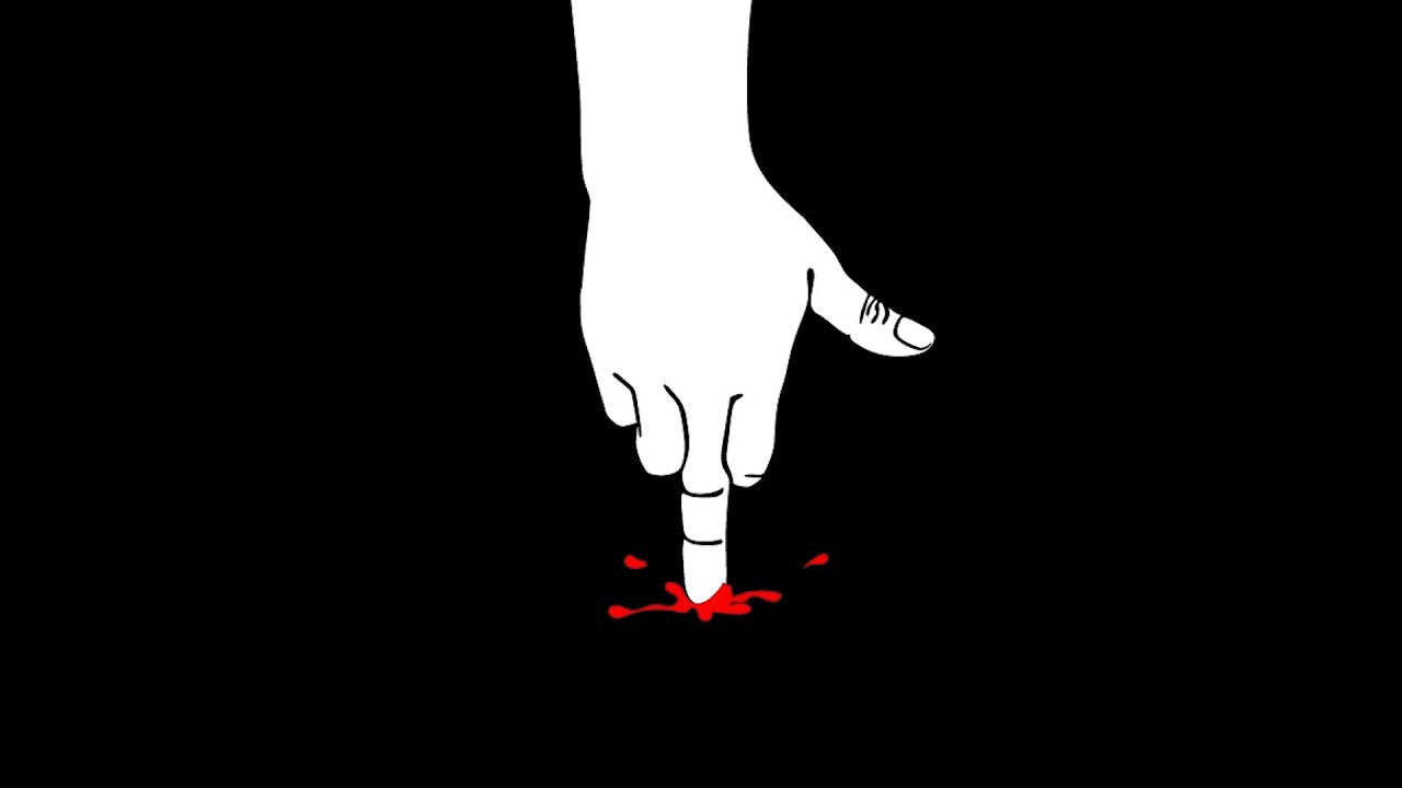 3 Pichurrio - FUC D FUC