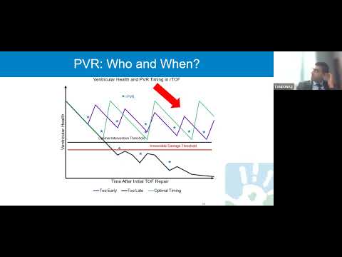 Invited Speaker Series with Dr. Animesh Tandon thumbnail