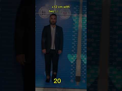 Pre-Op Height: 1.60 cm, Post-Op Height: 1.72 cm