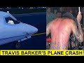 The Best 22 Back Travis Barker Burns