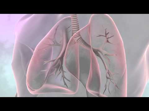What is lung cancer? | Cancer Research UK