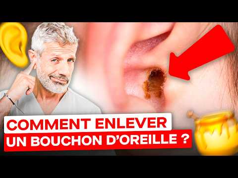 Comment Enlever un Bouchon de Cérumen ? (huile d'olive, bougies 😮 ?!)