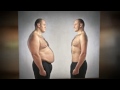 Top Weight Loss Programs & Bariatric Surgeries Abroad 