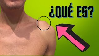Qué es esta bolita en el hombro