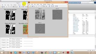 Identification of Diseases in Rice Plant using Back Propagation Artificial Neural Network