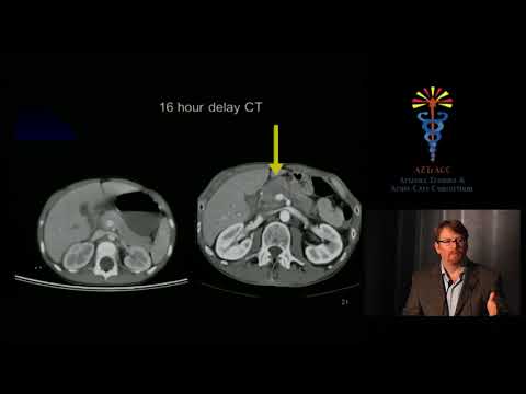 Using Non-Operative Management for a Trauma