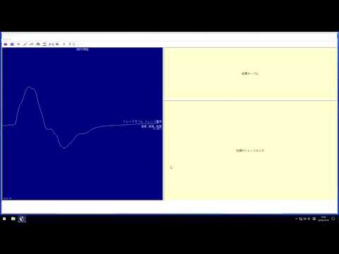 natus Nicolet EDX Viking cVEMP VEMP Recording