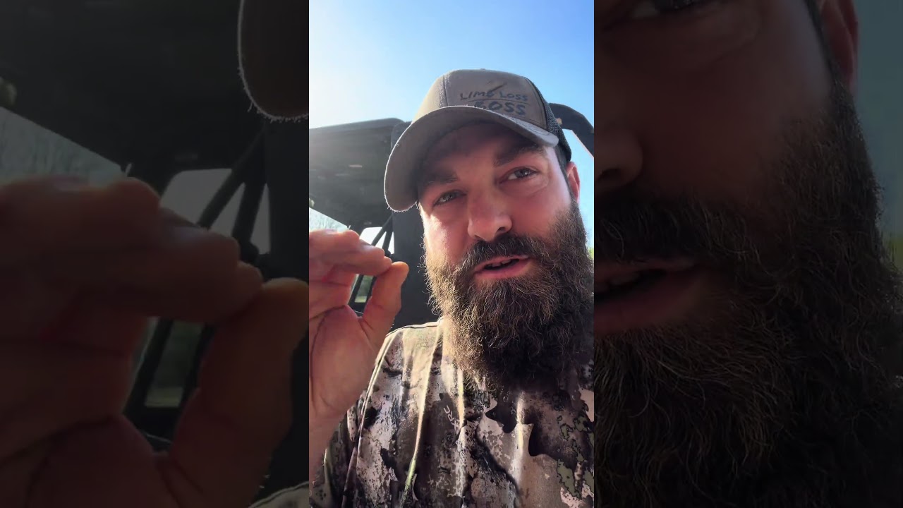 Uhhh-  what happened here? #limblossboss #dreamteamprosthetics #myleglesslife