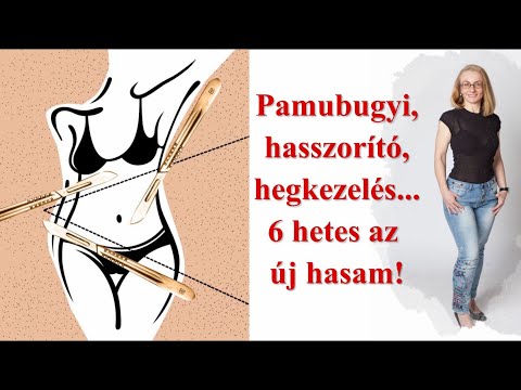 zsírvesztés a hasplasztika után annyira rosszul akarok lefogyni