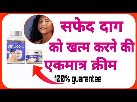 Vitiligo Care Cream & Capsule