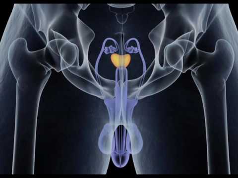Das heißt, wenn Sie Tabletten von Prostatitis trinken Indikatoren der Prostata TRUS
