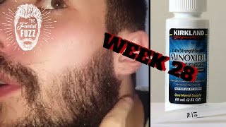 Minoxidil Beard | Week 28 | The Experiment | #Facialfuzzfridays