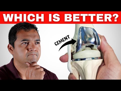 Cemented or Non-Cemented Knee Replacement?