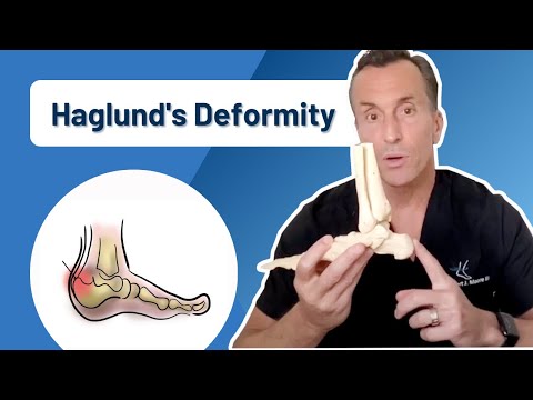 Cortisone Injection for Heel Pain Plantar Fasciitis