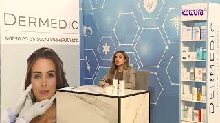 Ի՞նչ են իրենից ներկայացնում էկզեման ու ատոպիկ մաշկը / Խորհուրդ մասնագետից / Բուժ ինֆո/Buj Info