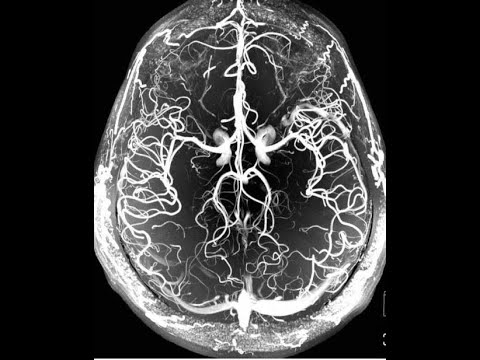 *free* supertrap x alien x redda x grim brxzy x matt ox hard type beat - "x-ray" (prod. webpunky)