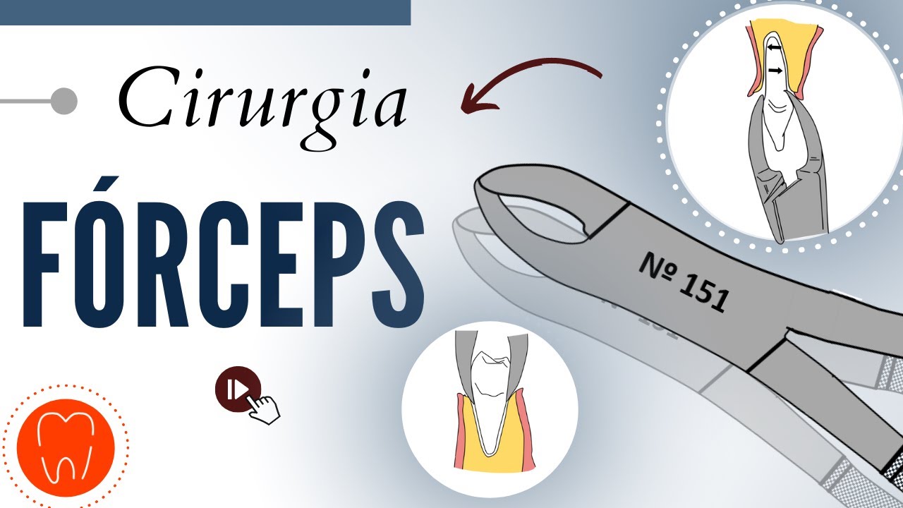 FÓRCEPS ODONTOLÓGICOS - FUNÇÃO, NUMERAÇÃO e INDICAÇÃO