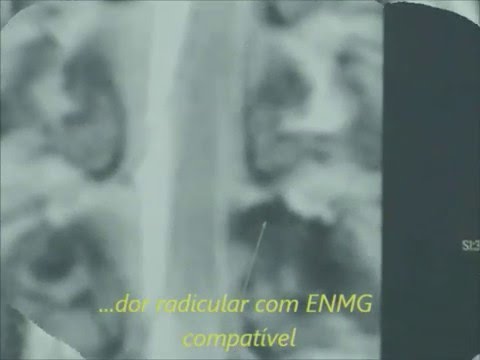 Pomata per giunti di mal di schiena Bassa schiena trattamento del dolore sciatica