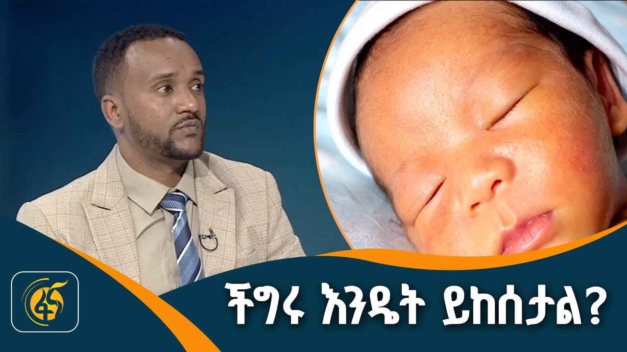 የጨቅላ ህፃናት ቢጫነት