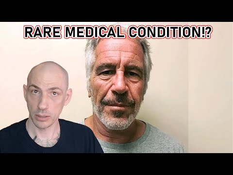 Jeffrey Epstein Had This RARE Condition (Right Wing Conspiracy Theory)