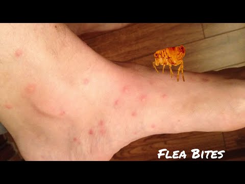 How Long Do Flea Bites Take to Appear in the Human Body, and Who’s at Risk Zone