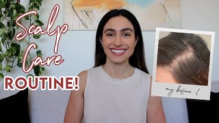My Scalp Care Routine: How I Stopped My Severe Seborrheic Dermatitis