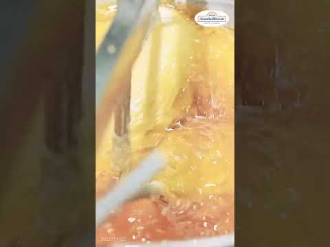 like comment and share