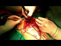 video thumbnail (18)
