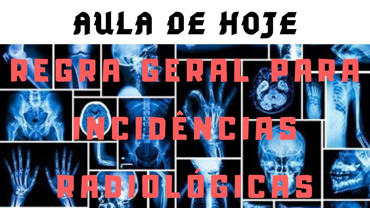 REGRA GERAL PARA INCIDÊNCIAS RADIOLÓGICAS