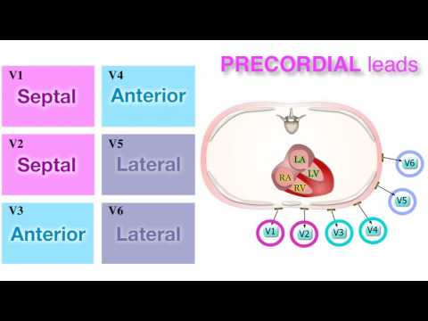 Ischemia 3/7 - Localization on ECG