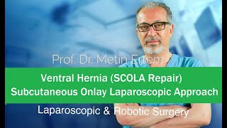 Miniaturka - SCOLA .Ventral Hernia. Subcutaneous Onlay Laparoscopic Approach. Metin Ertem. MD.FACS
