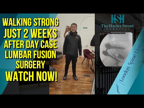 Walking Strong Just 2 Weeks After Day Case Lumbar Fusion Surgery – Watch Now!