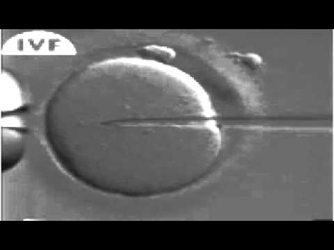 Advanced Fertility Clinic - Oman - IVF Procedure