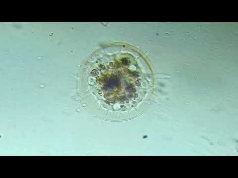 Testate amoebe: Arcella