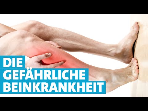 Warum die "Schaufensterkrankheit" so gefährlich ist | SWR | Landesschau Rheinland-Pfalz