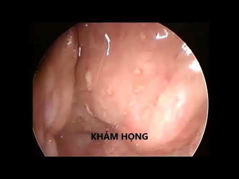 Nội soi tai mũi họng
